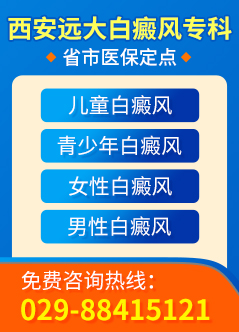 在线咨询
