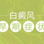 白癜风早期症状有什么