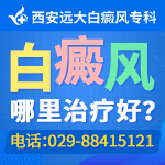 夏季白癜风护理应该注意什么